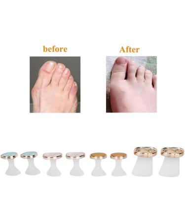 Toe Separators 8 Pcs Reusable Silicone Toe Spacers Nail Art Toe Separation Tool Pedicure Care(MY-02) - Buy Online on SooperMarket.com