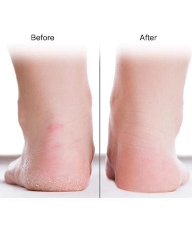 TsoLay 2X Moisturizing Silicone Sock Silicone Moisturizing Socks for Women and Men Foot Non-Slip Silicone Color - Buy Online on SooperMarket.com