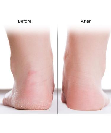 1 Pair Silicone Gel Moisturizing Socks Relieve Plantar Fasciitis Pain Heel Silicone Socks Foot Anti-Cracking Protector Foot Care Tool Prevention Socks (L-White) - Buy Online on SooperMarket.com