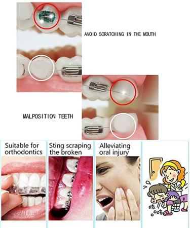 Angzhili 10 Pack Dental Orthodontics Wax for Brace Wearers Gum Protection (Multi-Color) - Buy Online on SooperMarket.com