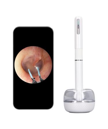 Ear Wax Removal Tool Ear Cleaner with Camera and LED Light Visible Ear Camera Otoscope 10MP 360 Degree Wide Angle Earwax Remover Picker Ear Pick for Adults and Kids (White)
