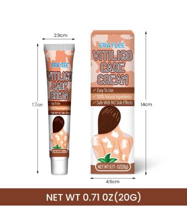 Natural Vitiligo Cream - Effective Treatment to Reduce White Spots & Improve Skin Pigmentation | International Shipping - Buy Online on SooperMarket.com