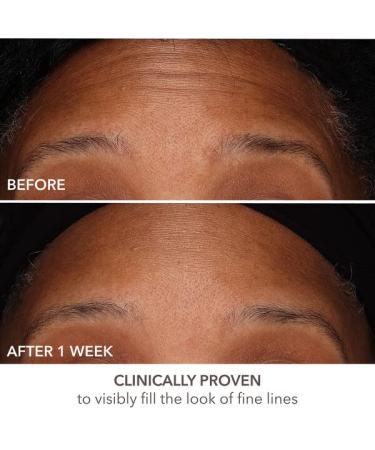 Dr. Dennis Gross DermInfusions Fill + Repair Serum - 1 oz | Fills Lines, Plumps, and Repairs - Buy Online on SooperMarket.com