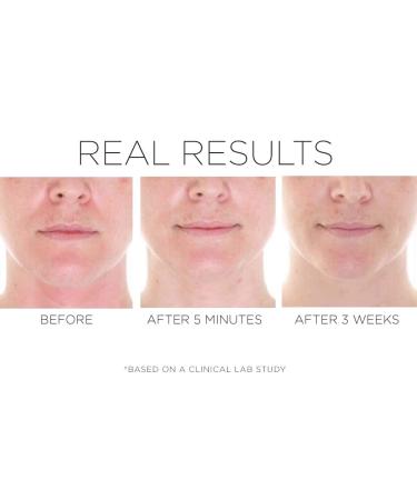 COSMEDIX CPR Skin Recovery Face Serum - Soothe & Protect Sensitive, Dry Skin with Peptides, Rhodiola, and Arnica Montana - Buy Online on SooperMarket.com