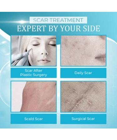 Anshka Organic Scar Removing Gel - Keloid & Surgical Scar Removal Cream for Lightening Scars and Acne Marks - 2pcs - Buy Online on SooperMarket.com