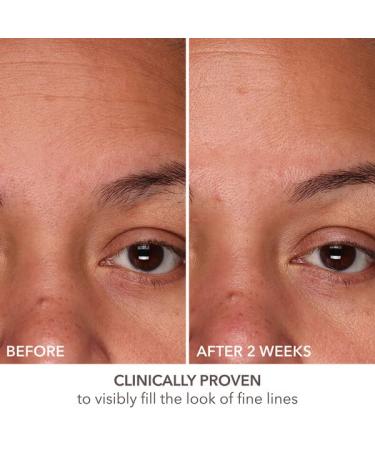 Dr Dennis Gross DermInfusions Fill + Repair Serum - Instant Line Filler & Skin Plumper 1 oz | International Shipping Available - Buy Online on SooperMarket.com