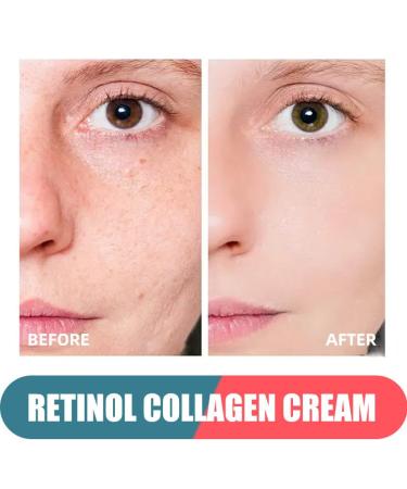 Buy Retinol Cream with Hyaluronic Acid - Anti-Aging Day-Night Moisturizer for Men & Women | Reduces Wrinkles & Dryness - 1.78 Oz - Buy Online on SooperMarket.com