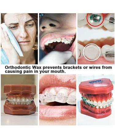 Angzhili 10 Pack Dental Orthodontics Wax for Brace Wearers Gum Protection (Multi-Color) - Buy Online on SooperMarket.com