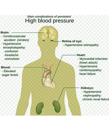 Hypertension Patch Lowering Blood Pressure 100% Natural (1 Box)14 Patches - Buy Online on SooperMarket.com