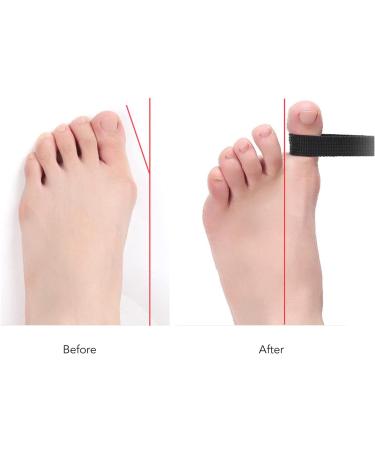 Bunion Toe Straightener & Corrector Stretchy Belt for Pain Relief and Toe Realignment | Flexibility Training Big Toe Corrector Strap - Buy Online on SooperMarket.com