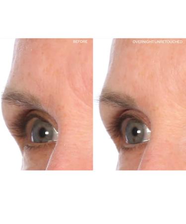 SiO Beauty Mid-Brow Forehead Anti-Wrinkle Patch - Overnight Silicone Patch for Furrows, Expression Lines, and 11s - Buy Online on SooperMarket.com