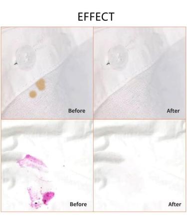 Stain Remover Pen - Wash Free Bleach Pen for Clothing | Remove Coffee Food Red Wine & Lipstick Stains | 3 Pack - Buy Online on SooperMarket.com