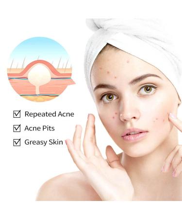 Onkessy Repair Acne Cream - Pimple Treatment for Men and Women - Hydrating & Oil Control Formula for Quick Acne Removal - Buy Online on SooperMarket.com