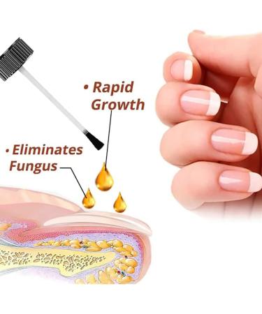 Buy Tlopa Nail Growth and Strengthening Serum - Nail Repair Solution (2 Pieces) for Stronger Healthier Nails Worldwide - Buy Online on SooperMarket.com