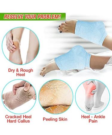 Nado Care 4 Pairs Heels Moisturizing Socks for Dry Cracked Heels Repair - Gel Heel Sleeves - Open Toe Comfy Socks - Pink Blue Grey Black - Buy Online on SooperMarket.com