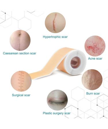 Silicone Scar Tape 4cm x 1.5m - Self Adhesive & Non-irritating - C Section & Burn Scar Removal - Meat Color - Buy Online on SooperMarket.com