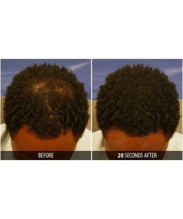 Dr. Yates MD Keratin Fiber Hair Enhancer - Dark Brown | Instantly Thicker Hair Solution - Buy Online on SooperMarket.com