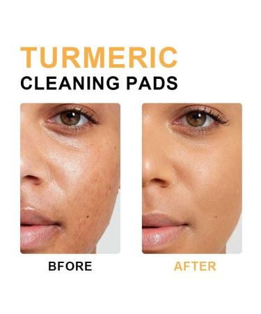 Turmeric Kojic Acid Cleansing Pads | Exfoliating Facial Sponges - 40 Count for Bright & Clear Skin - Buy Online on SooperMarket.com
