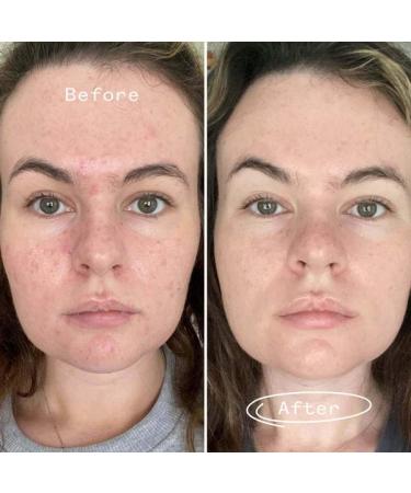 Buy PAI Skincare Organic Carbon Star Detoxifying Overnight Face Oil | Natural Vegan Sensitive Skincare | International Shipping 1 fl oz (30 ml - Buy Online on SooperMarket.com