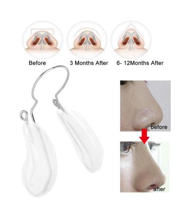 Nose Up Clip - Enhance Your Nose Shape & Lift with Our Beauty Reshaper for Wide & Crooked Noses - International Shipping Available - Buy Online on SooperMarket.com