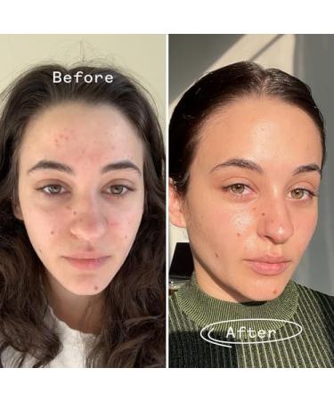Buy PAI Skincare Organic Carbon Star Detoxifying Overnight Face Oil | Natural Vegan Sensitive Skincare | International Shipping 1 fl oz (30 ml - Buy Online on SooperMarket.com