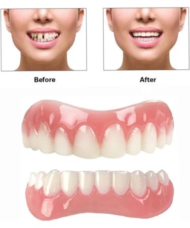 Fake Teeth Upper and Lower Veneer Dentures (2PCS) for Men and Women - Buy Online on SooperMarket.com