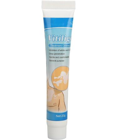 Vitiligo Cream 30G - Herbal Extract Treatment for White Spots & Skin Pigmentation - Creme Medix Leukoplakia Solution - 0.7oz - Buy Online on SooperMarket.com
