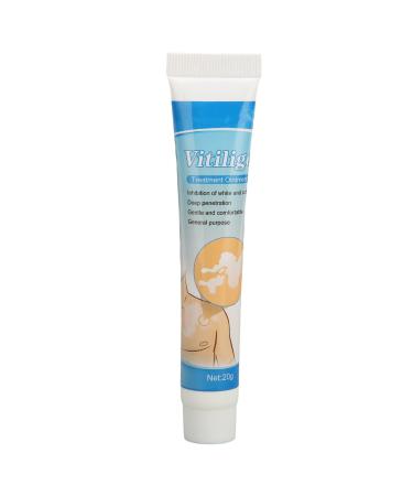 plplaaoo Herbal Extract White Spots Vitiligo Treatment Ointment 0.7oz Vitiligo Cream ortable Herbal Vitiligo Treatment Cream Vitiligo Treatment Cream Suitable for Skin Pigmentation