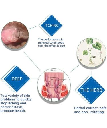 Healmusz Natural Herbal Hemorrhoids Ointment Healmusz Hemorrhoid Ointment Chinese Herbal Hemorrhoids Cream Organic Herbal Hemorrhoids Ointment 0.7Oz/20g (1pcs) - Buy Online on SooperMarket.com