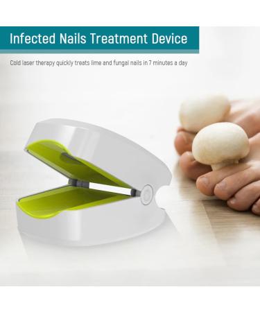 Lanlousy 905NM Nail Therapeutic Instrument Portable Painless Nail Therapy Device Anti- Silicone Easy to Use White - Buy Online on SooperMarket.com