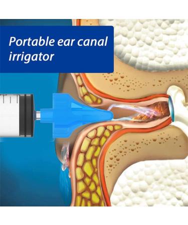 Ear Wax Cleaner Syringe - 1PC 10ML Ear Irrigation Tool for Adults & Children - Buy Online on SooperMarket.com