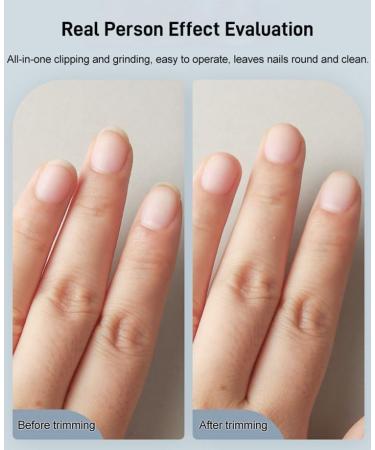 Electric Automatic Nail Clipper Nail Trimmer Electric Rechargeable Nail Cutter File with Light and Nail Scraps Storage fof Kids Seniors Adult /965 White - Buy Online on SooperMarket.com