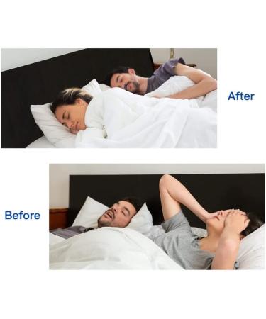 Automatic Snore Stopper for Men and Women - Extra Strength Anti Snoring Solution - Nasal Dilator Nose (Blue) - Buy Online on SooperMarket.com