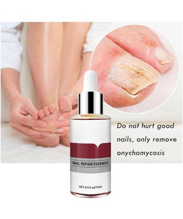 1PC Nail Treatment Toenail Treatment Nail Renewal Solution Toenails & Fingernails Nail Repairs Essential Oil Protects From Discoloration Brittle And Cracked Nail(12ML) - Buy Online on SooperMarket.com