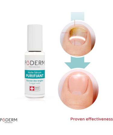 PODERM 2-in-1 Fungal Infection Nail Treatment | Powerful Anti-Fungal Formula | Swiss Made - Buy Online on SooperMarket.com