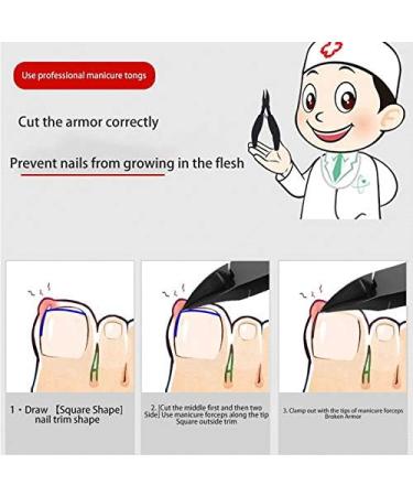 ISTOVO 4Pcs/Lot Paronychia Nail Tools Nail Clipper Nail Correction Thick Nails Ingrown Toenails Nippers Dirt Remover - Buy Online on SooperMarket.com