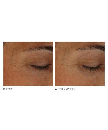 Dr Dennis Gross B Adaptive SuperFoods Stress SOS Eye Cream - 0.5 fl oz | Targets Tired Eyes, Worry Lines, Crepiness & Puffiness - Buy Online on SooperMarket.com