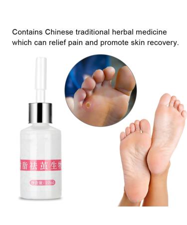Foot Corn Plaster 10ml - Callus & Corn Removal Cream for Pain Relief - Buy Online on SooperMarket.com
