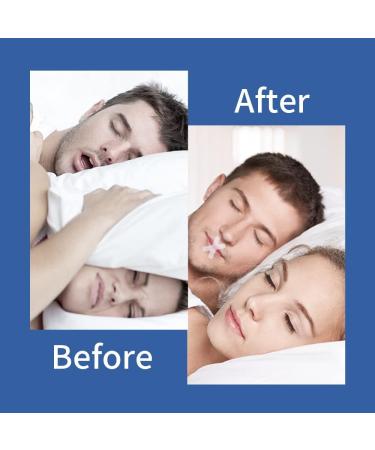 120 PCS Snore Reducing Mouth Tape for Sleeping - Stop Snoring with Sleep Tape - Buy Online on SooperMarket.com
