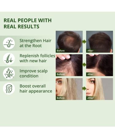 Buy Batana Oil - 100% Pure Raw Hair Growth Oil - 4.23 OZ | Promote Hair Thickness | Organic & Unrefined | Men & Women | International Shipping - Buy Online on SooperMarket.com