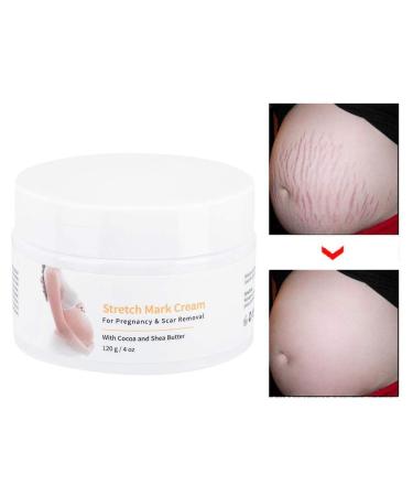 Stretch Stripes Cream 120g | Remove Stretch Marks Pregnancy Scars & Acne | Maternity Repair Treatment - Buy Online on SooperMarket.com
