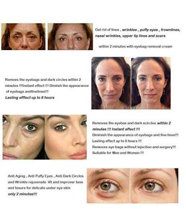 2pcs Silk Protein Anti-Aging Eye Cream for Wrinkles, Dark Circles, Fine Lines - Firming & Repair Eye Serum - Buy Online on SooperMarket.com