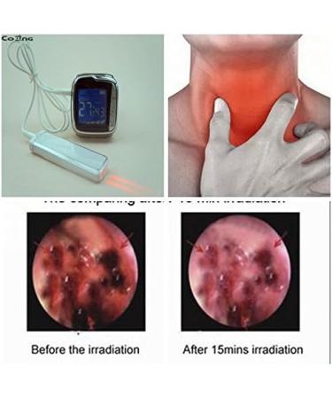 Therapeutic Laser Wrist Watch Blood Pressure and Intranasal Irradiation - Buy Online on SooperMarket.com