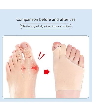 IYSHOUGONG Big Toe Hallux Valgus Corrector - Silicone Feet Care for Bone Thumb Alignment - Buy Online on SooperMarket.com