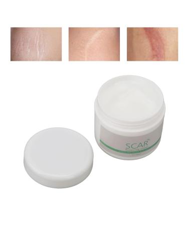 Jopwkuin Scar Removal Cream - Reduce Wrinkles & Soothe Surgery Scars - For Men - Buy Online on SooperMarket.com