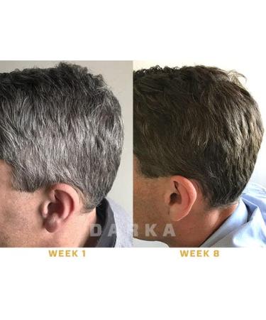 DARKA Pro Anti-Greying Hair Serum with Ganoderma Nutrient - Promotes Healthier, Thicker Hair - 2pcs - Buy Online on SooperMarket.com
