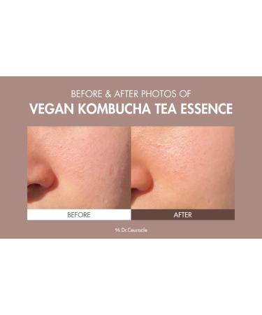 Leegeehaam Dr.Ceuracle Vegan Kombucha Tea Special Set - Korean Hydrating & Nourishing Skincare Gift Set | Essence Gel Cream & Lip Balm - Buy Online on SooperMarket.com
