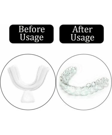 12PCS Silicone Mouth Guard Teeth Night Clenching Grinding Sleep Dental Care - Buy Online on SooperMarket.com