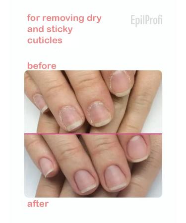 SOS Manicure Cuticle Remover Cream - Professional 1 Oz | Best for Nail Care & Grooming - Buy Online on SooperMarket.com