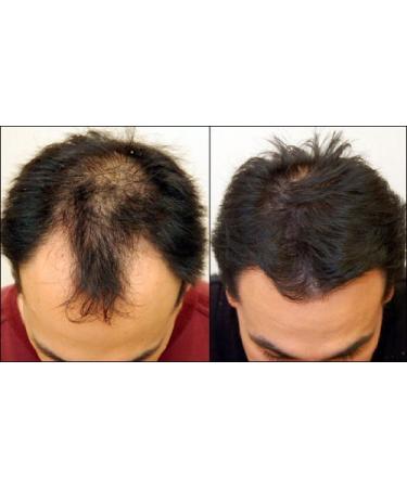 Nutrifolica Hair Loss Volumizing Conditioner 2 Month Supply | International Shipping Available - Buy Online on SooperMarket.com